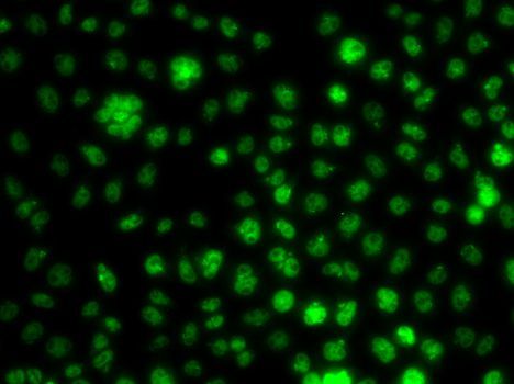 Immunofluorescence - UBE2R2 antibody (144-07373)