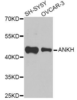 Western blot - ANKH Antibody (144-09881)