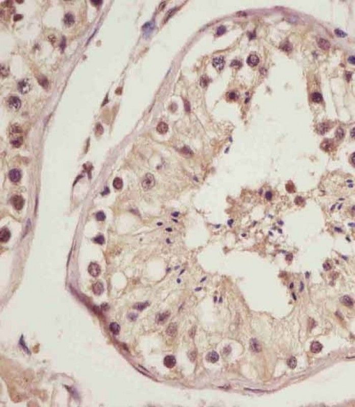 IHC-P