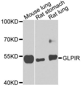 Western blot - GLP1R Polyclonal Antibody (144-08547)
