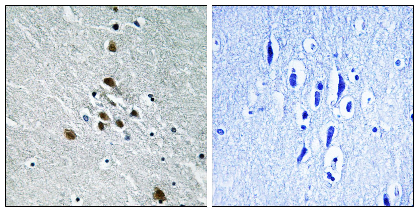 IHC
