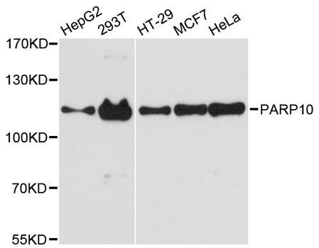 Western blot - PARP10 antibody (144-12815)