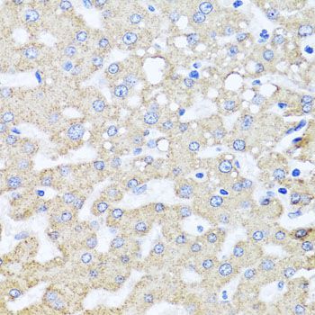 Immunohistochemistry - ARL6 antibody (144-08269)