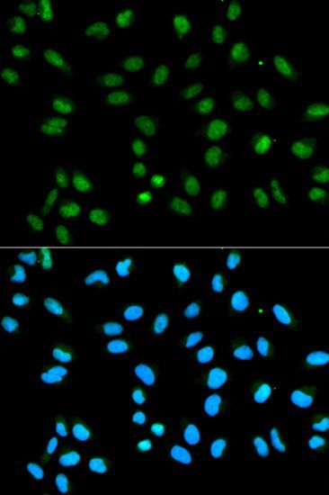 Immunohistochemistry - [KO Validated] HNRNPA2B1 Polyclonal Antibody (144-01162)