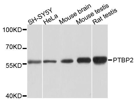 Western blot - PTBP2 Polyclonal Antibody (144-06054)
