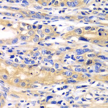 Immunohistochemistry - SARS antibody (144-602970)