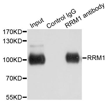 Immunoprecipitation - RRM1 Polyclonal Antibody (144-602928)