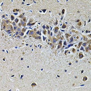 Immunohistochemistry - PLCG1 Antibody (144-07711)