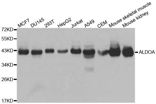Western blot - ALDOA Polyclonal Antibody (144-01142)