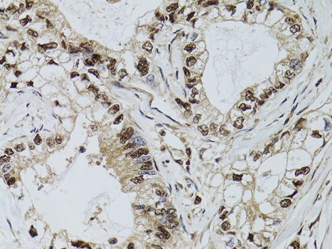 Immunohistochemistry - DCK antibody (144-01794)