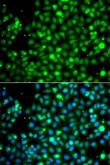 Immunofluorescence - NME2 antibody (144-07443)