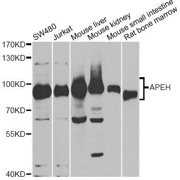 Western blot - APEH antibody (144-603447)
