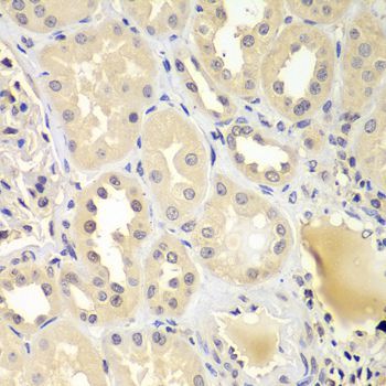 Immunohistochemistry - UBE2Z Polyclonal Antibody (144-07225)