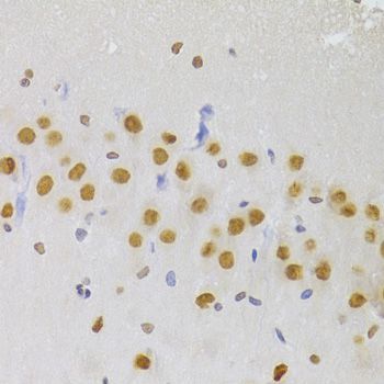 Immunohistochemistry - HNRNPA1 Polyclonal Antibody (144-07491)