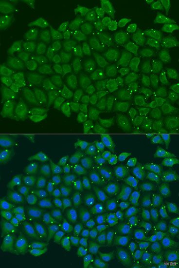 Immunofluorescence - TNNC2 antibody (144-07740)