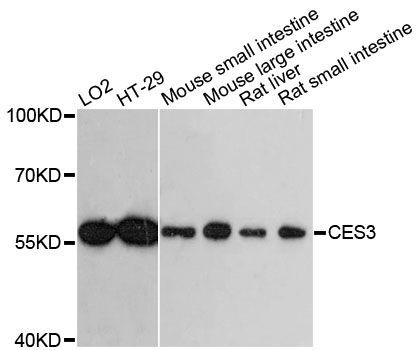 Western blot - CES3 antibody (144-61390)
