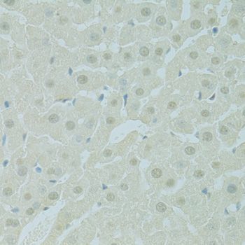 Immunohistochemistry - PHOX2B antibody (144-09685)