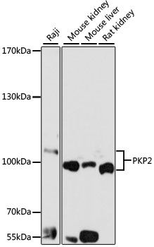 Western blot - PKP2 antibody (144-05507)