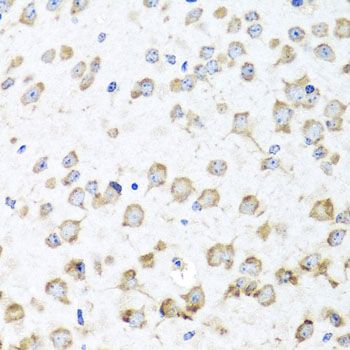 Immunohistochemistry - RPL36 Polyclonal Antibody (144-07793)