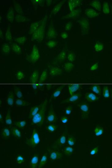 Immunofluorescence - ARRB1 Polyclonal Antibody (144-00998)