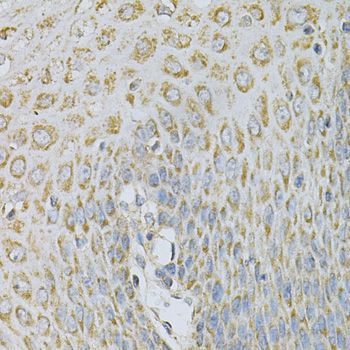 Immunohistochemistry - AP2B1 Antibody (144-01995)