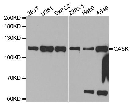 Western blot - CASK antibody (144-02501)