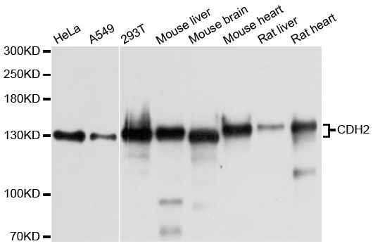 Western blot - CDH2 Polyclonal Antibody (144-03045)