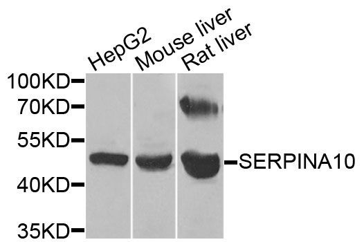 Western blot - SERPINA10 Polyclonal Antibody (144-07106)