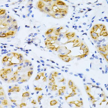 Immunohistochemistry - CYP2E1 Polyclonal Antibody (144-61331)