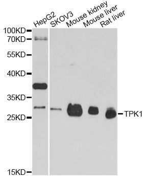 Western blot - TPK1 antibody (144-04634)