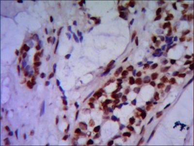 IHC