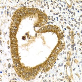 Immunohistochemistry - [KO Validated] RAB27A Polyclonal Antibody (144-01934)