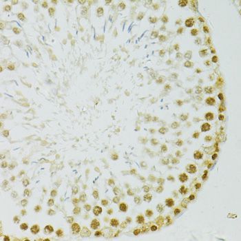 Immunohistochemistry - ADAR Polyclonal Antibody (144-07869)