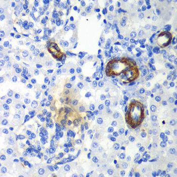 Immunohistochemistry - AIMP1 antibody (144-05301)