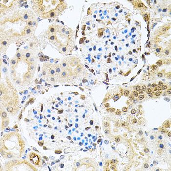 Immunohistochemistry - PNKP antibody (144-06693)