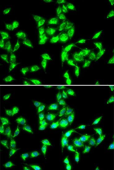Immunofluorescence - ANTXR1 Polyclonal Antibody (144-06525)