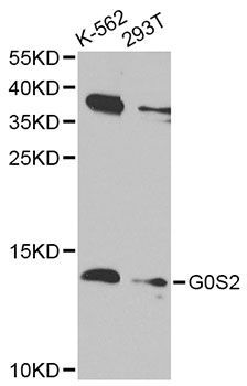 Western blot - G0S2 antibody (144-014125)