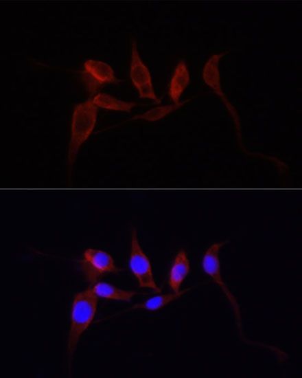 Immunofluorescence - [KO Validated] YAP1 Polyclonal Antibody (144-01002)