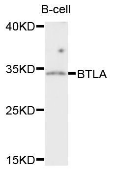 Western blot - BTLA antibody (144-60340)