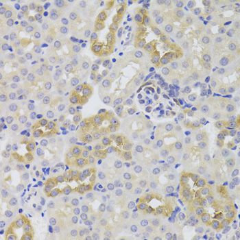 Immunohistochemistry - TSC22D3 Polyclonal Antibody (144-06779)