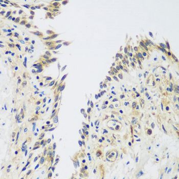 Immunohistochemistry - UPF2 antibody (144-07091)