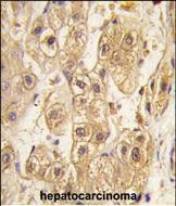 IHC-P