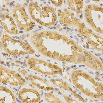 Immunohistochemistry - CDC42 Antibody (144-01188)