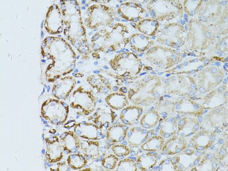 Immunohistochemistry - OCLN antibody (144-02601)