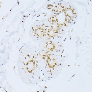 Immunohistochemistry - ZEB2 Polyclonal Antibody (144-05705)