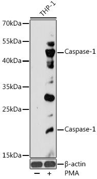 Western blot