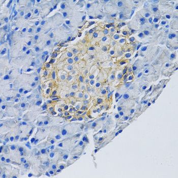 Immunohistochemistry - SLC1A2 Polyclonal Antibody (144-00910)