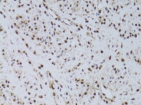 Immunohistochemistry - HUS1 antibody (144-60528)