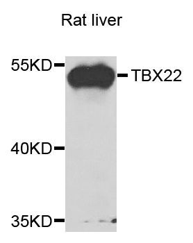 Western blot - TBX22 antibody (144-07801)