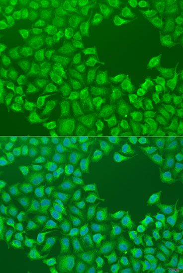 Immunofluorescence - CEP57L1 antibody (144-08290)
